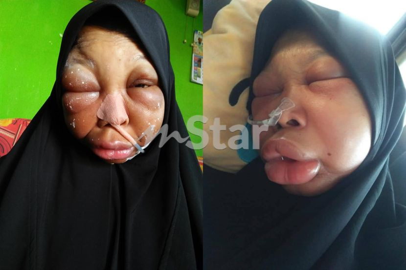 Wanita derita kanser lidah pergi jua sempat tulis 