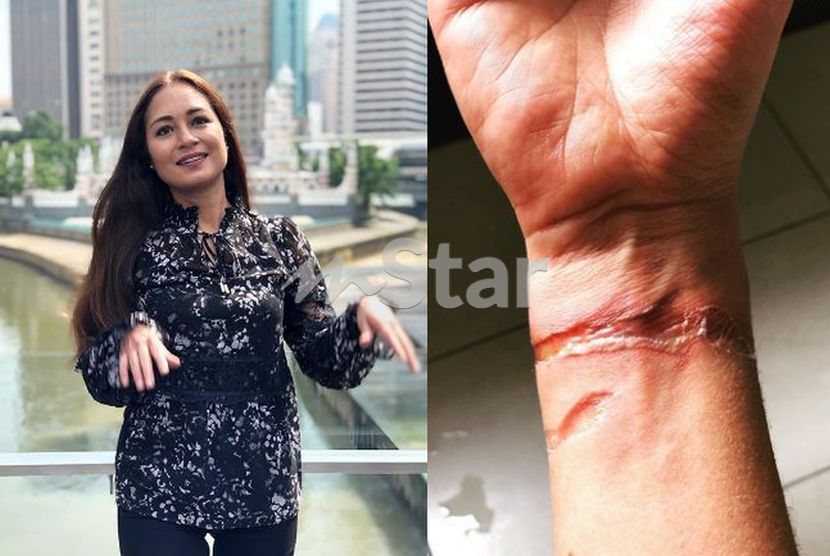 Tangan Maya Karin Melecur Gara Gara Selamatkan Periuk Panas “jika Tidak