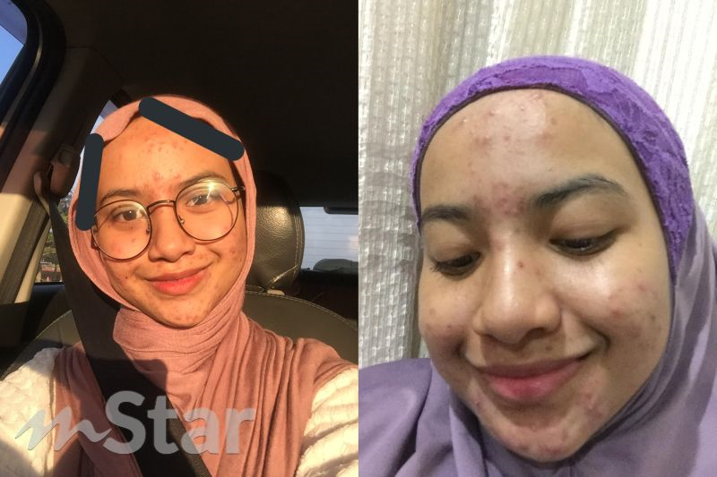 Muka Anak Disamakan Macam Bulan Ibu Yang Rasa ‘sakit Nekad Bawa Gadis