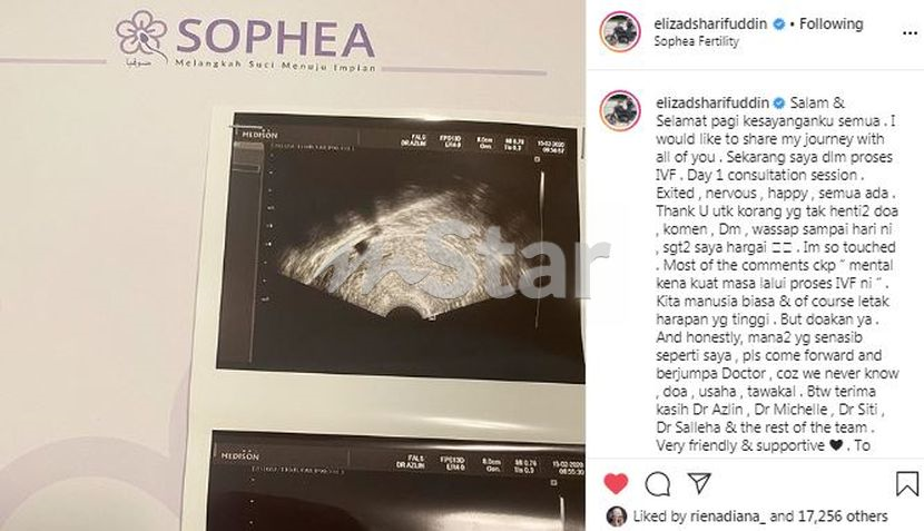 Siti Elizad Jalani Rawatan Ivf Buat Pertama Kali Mental Kena Kuat Doakan Saya Hiburan Mstar