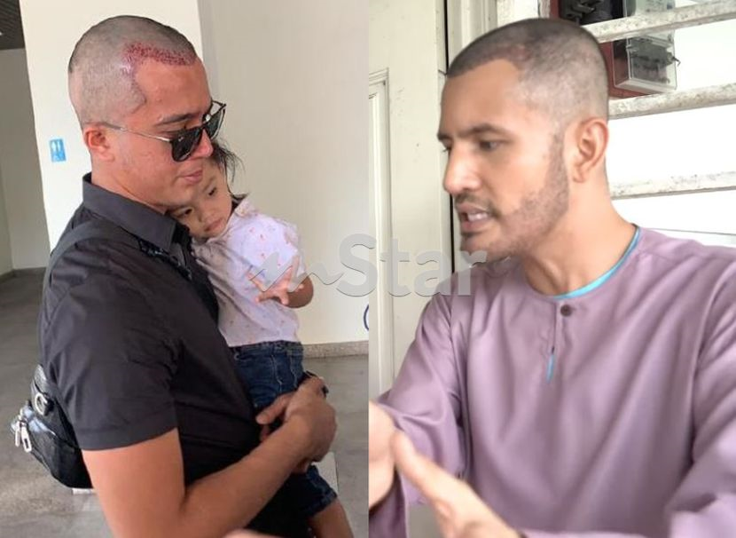 Tanam rambut juga ke?u201d - Netizen samakan kepala Aliff Syukri 