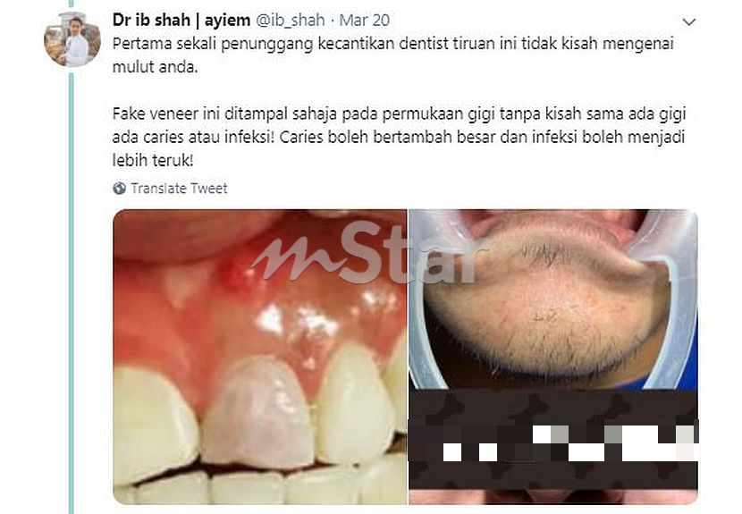 harga gigi palsu klinik kerajaan