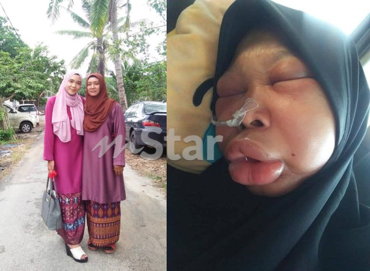 Tak Boleh Cakap Lidah Mak Keras Sepenuhnya Bermula Dari Ulser Kini Leher Berlubang Anak Kongsi Derita Ibu Hidap Kanser Viral Mstar