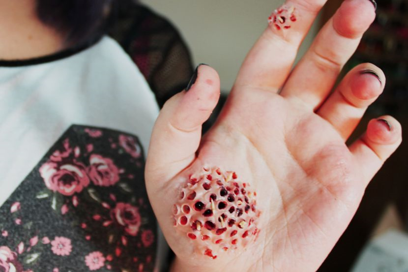 Geli Tengok Lubang Lubang Kecil Jangan Bimbang Ini Tip Bantu Anda Atasi Trypophobia Famili Mstar