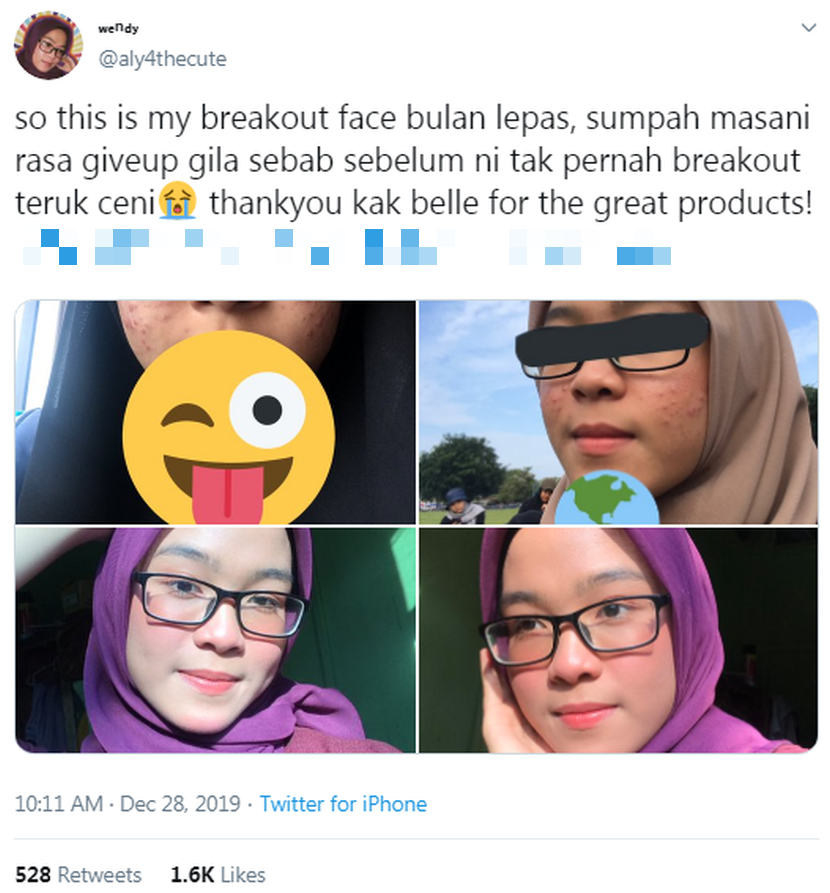 Muka jerawat teruk selepas mandi kolam, pakwe terus minta ...