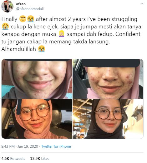 Muka anak disamakan macam bulan, ibu yang rasa 'sakit 