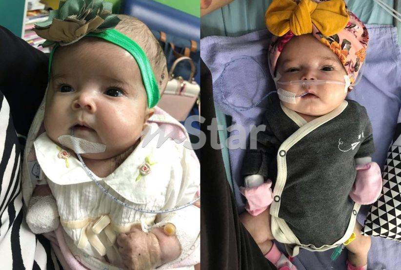 Derita bayi 3 bulan hidap kanser otak, tiada suara, tak boleh melihat