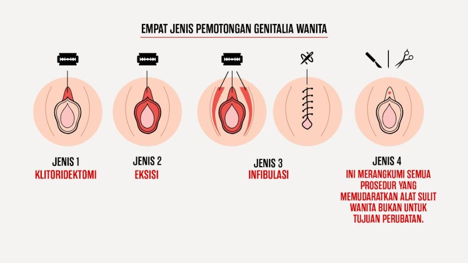 Khatan perempuan hukum Hukum, Tujuan